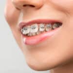 pediatric dentist in spring
