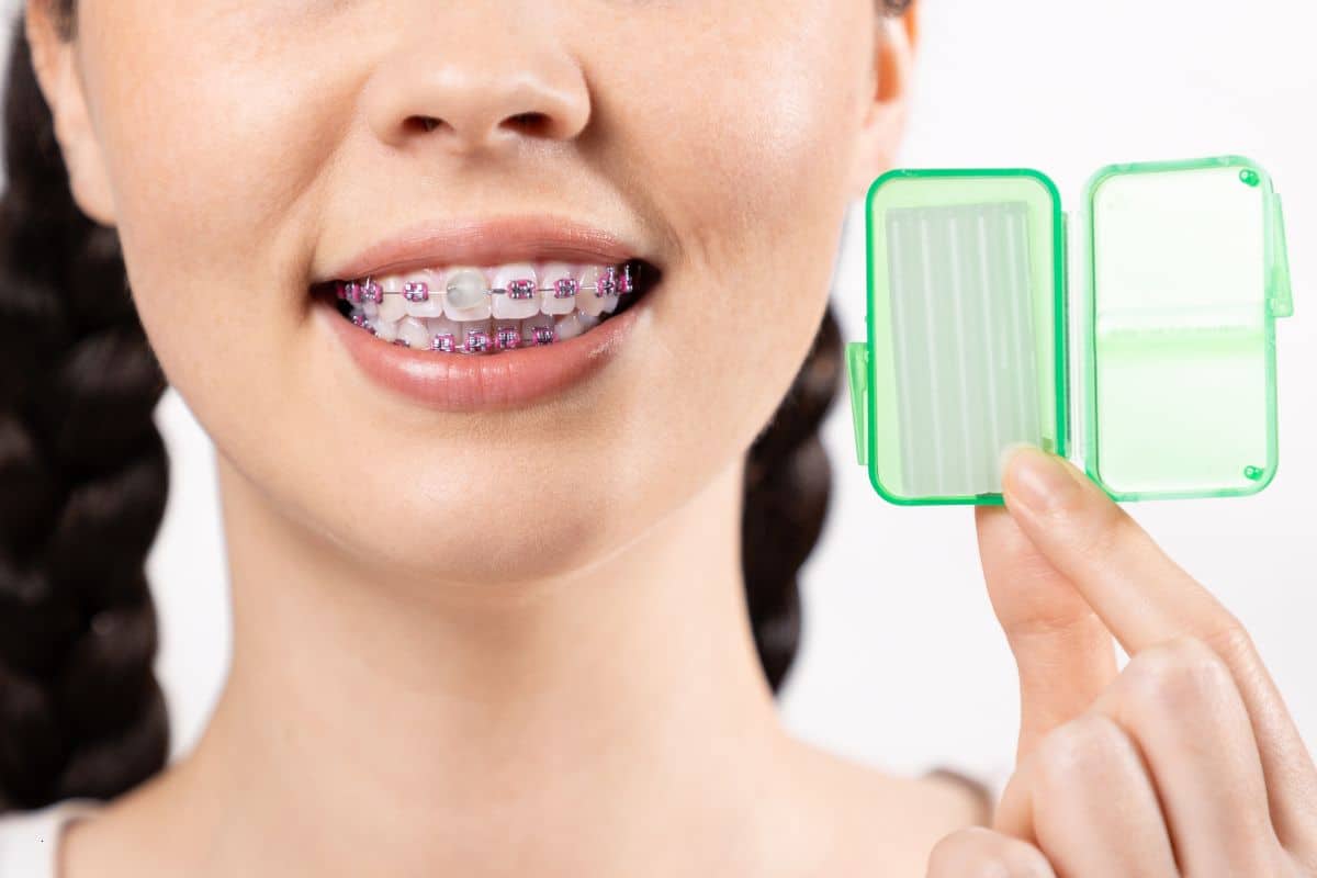 Orthodontist in Spring