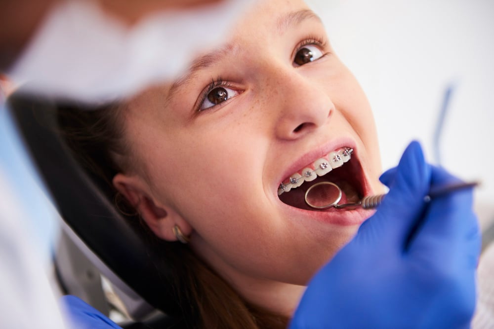 pediatric dentist spring