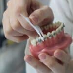 orthodontic treatment spring