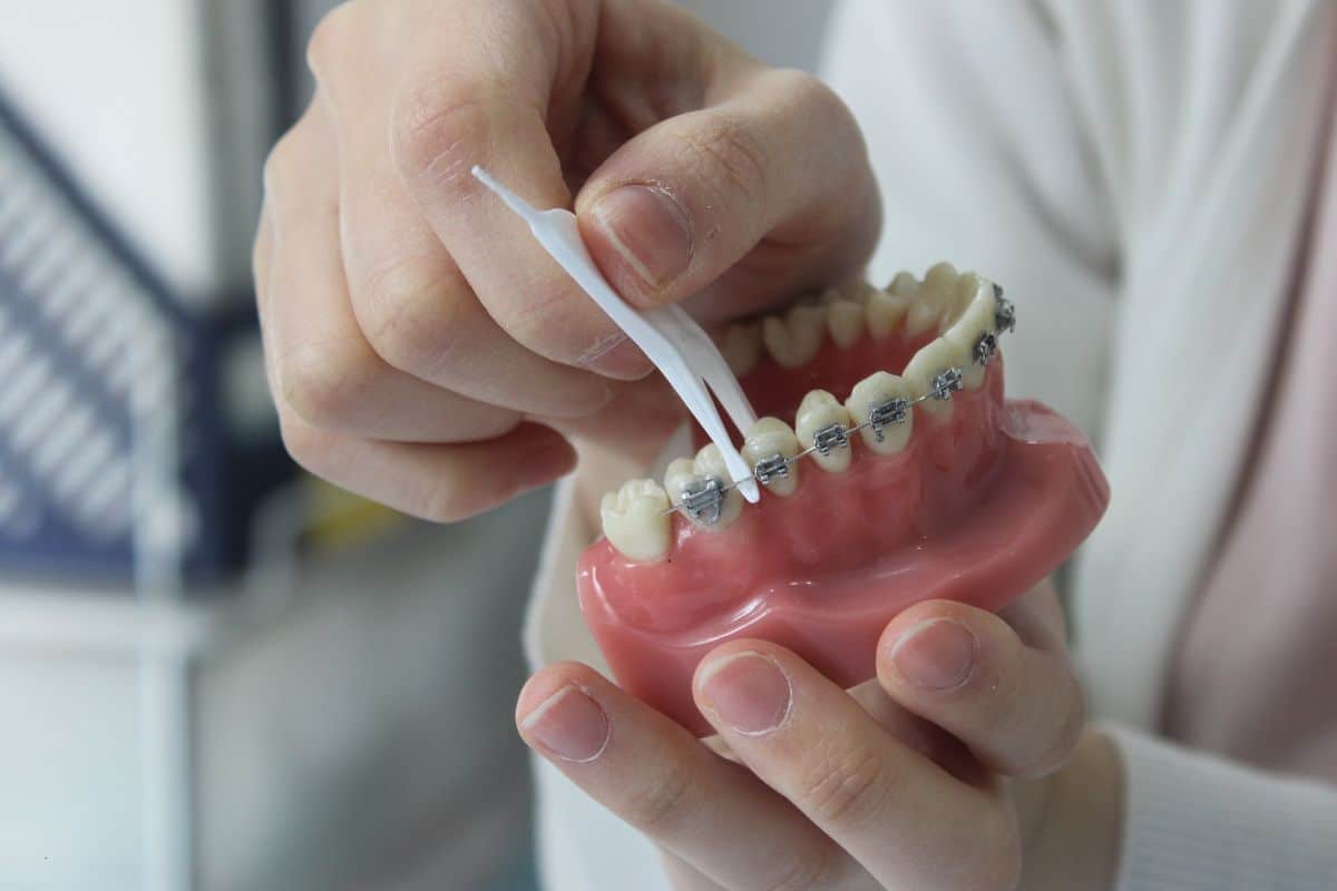 orthodontic treatment spring