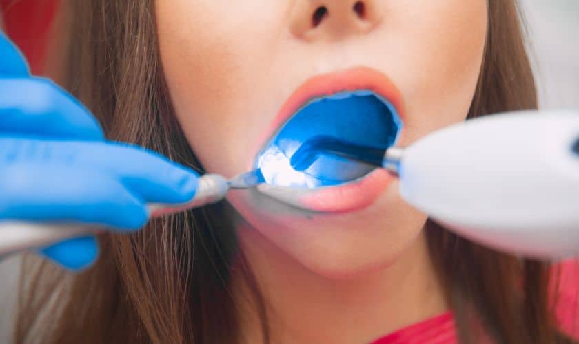 Restorative Dentistry For Children: Fostering Healthy Smiles