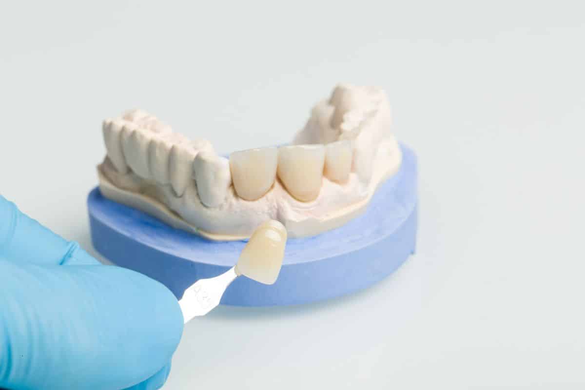 pediatric dentist spring