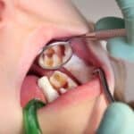 pediatric dentist spring