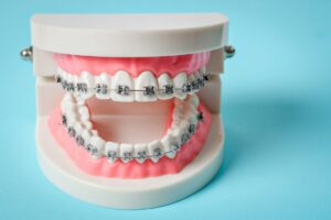 orthodontic treatment spring