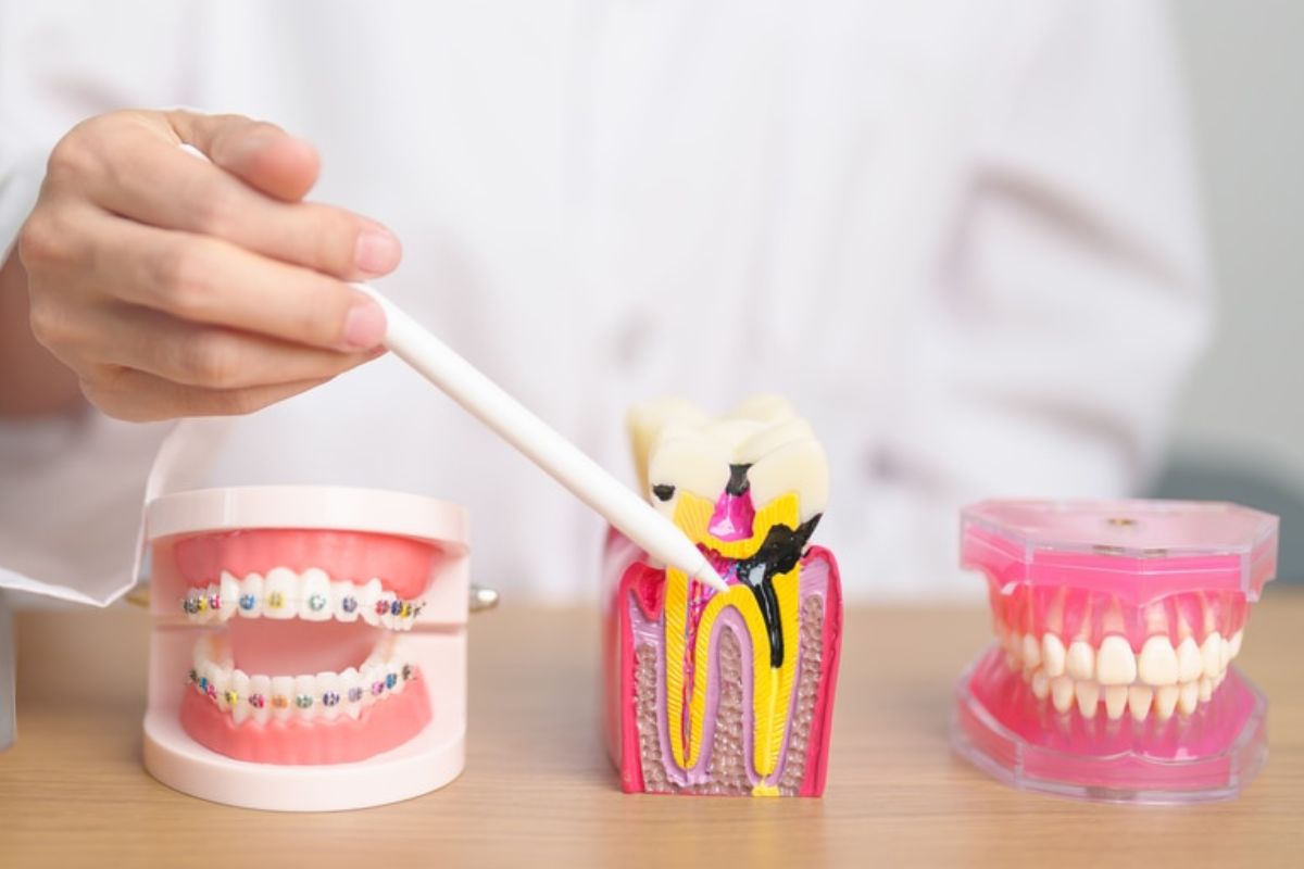 orthodontic treatment spring