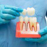 pediatric dentist spring