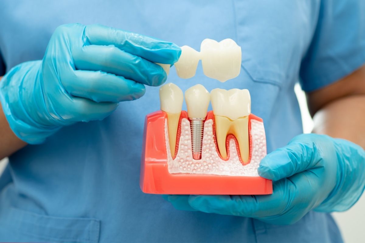pediatric dentist spring