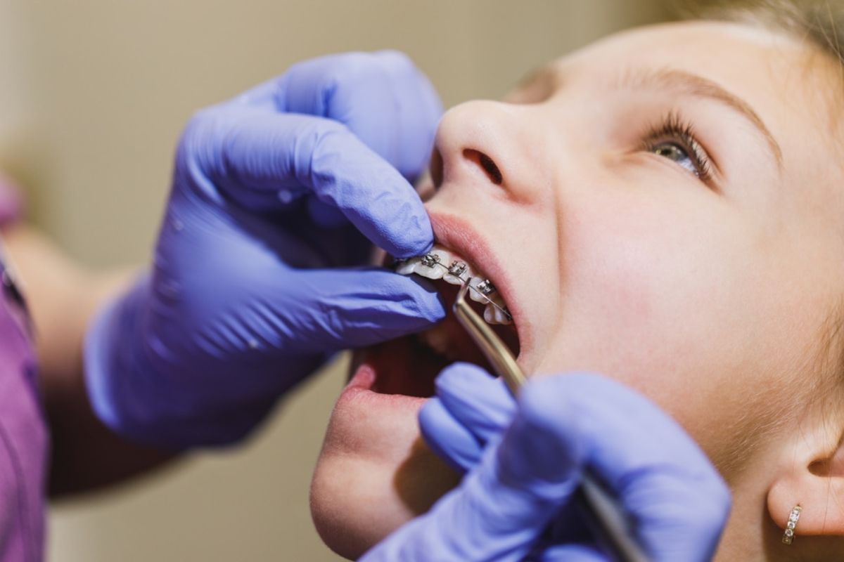orthodontic treatment spring