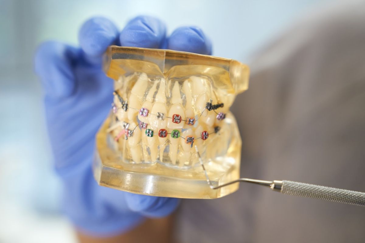 orthodontic treatment spring