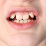 orthodontist in spring