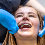 Orthodontist adjusting braces during a tightening appointment for a teenage patient in a dental chair