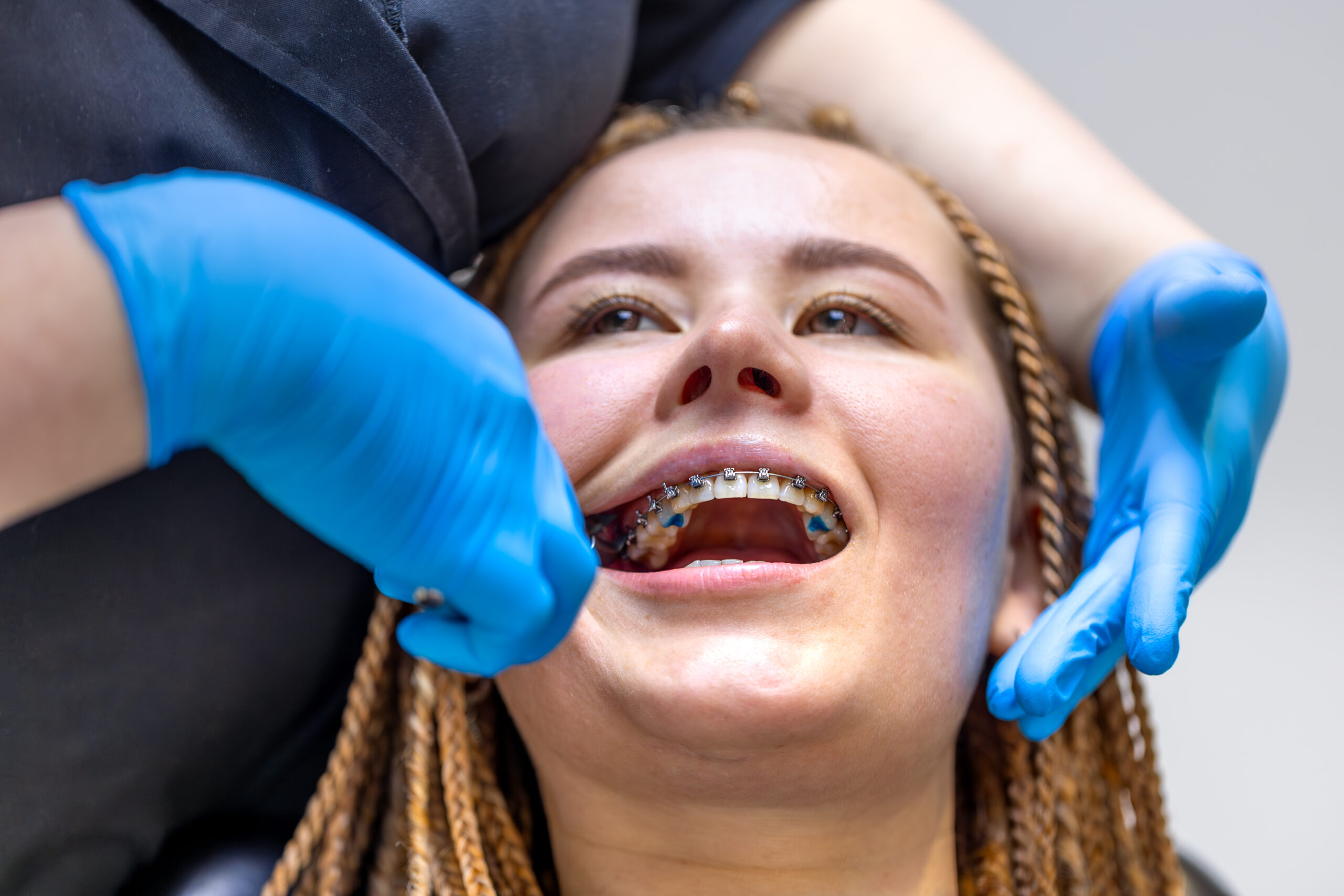 Orthodontist adjusting braces during a tightening appointment for a teenage patient in a dental chair
