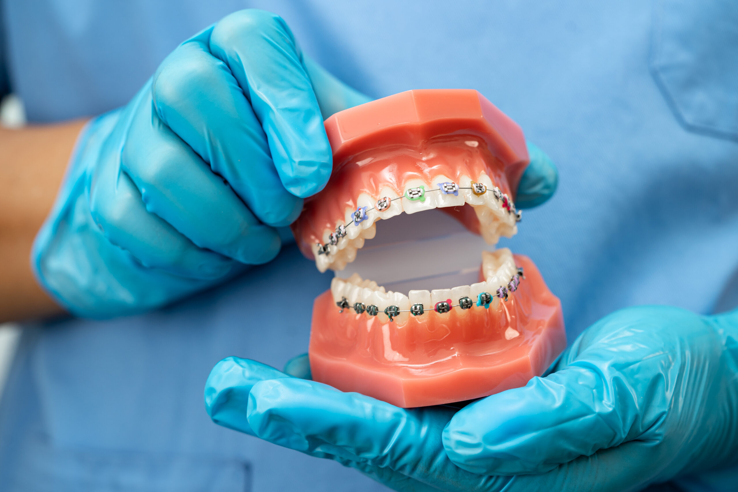 Orthodontist holding a dental model showing braces and proper alignment during treatment explanation