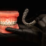 Dental model showing metal braces and clear aligners for smile correction