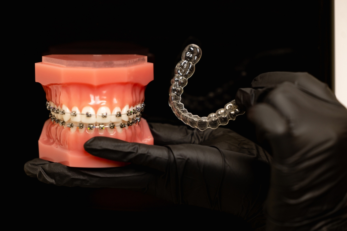 Orthodontic treatment improving oral health with braces and Invisalign
